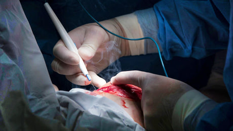 Electrosurgical Unit: How It Works, Types, and Application Overview