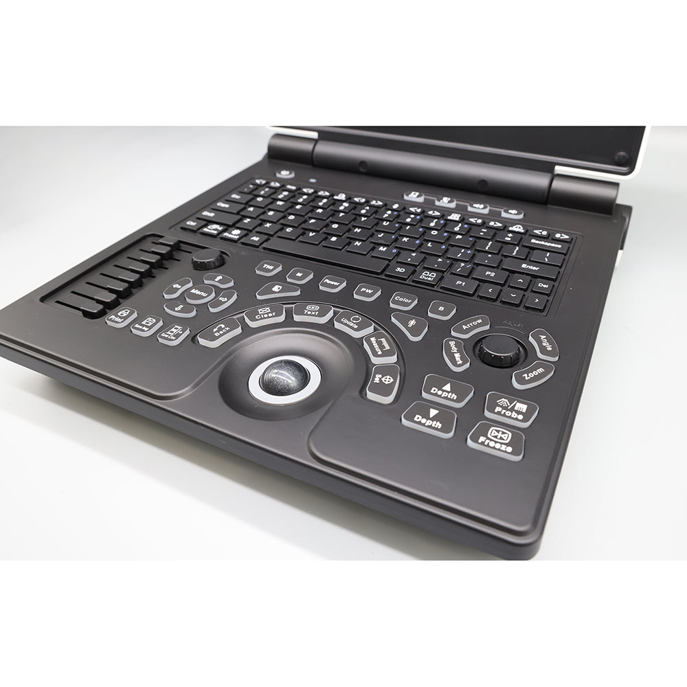 Portable Color Doppler Ultrasonic Machine Full Digital Clinic Ultrasound Machine