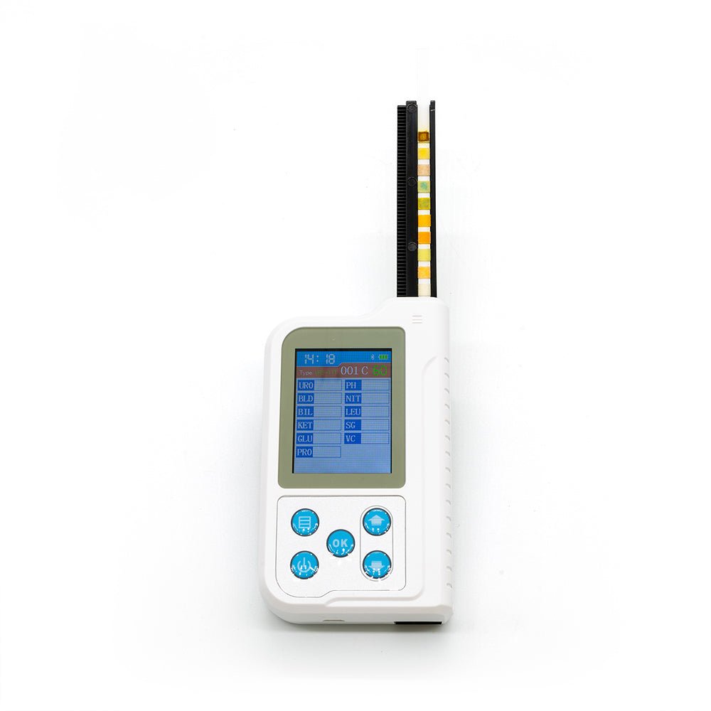 Handheld Portable Urine Analyzer Machine