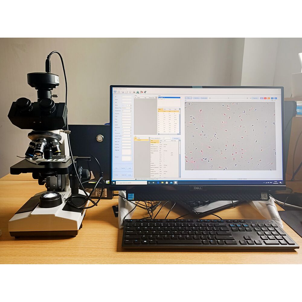 Semen Analysis Machine Microscope Sperm Quality Analyzer