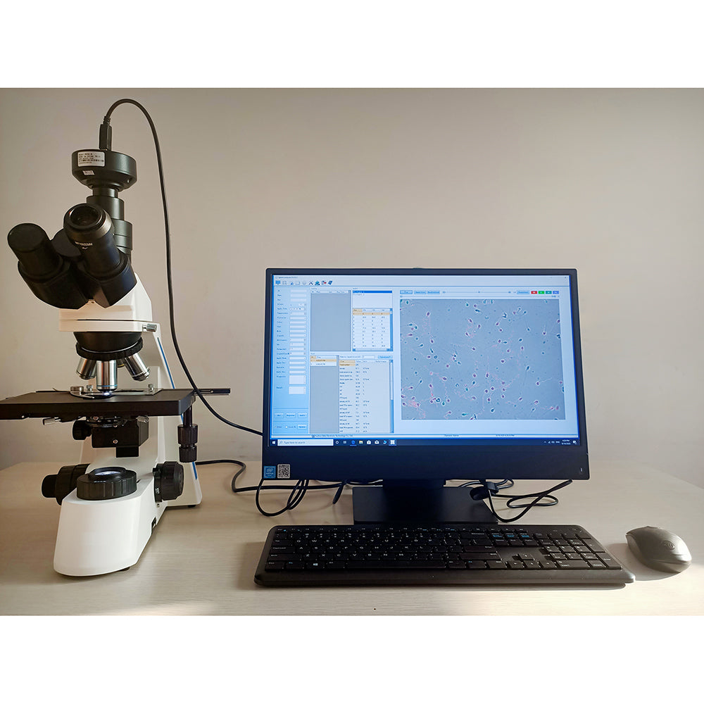 Semen Analyser Portable Laptop Semen Analysis Sperm Analyzer