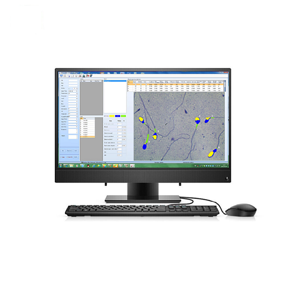 Semen Analyser Portable Laptop Semen Analysis Sperm Analyzer