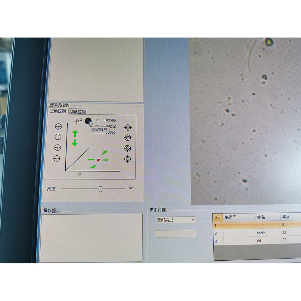 Fully Automatic Semen Analyzer Sperm Quality Analyzer