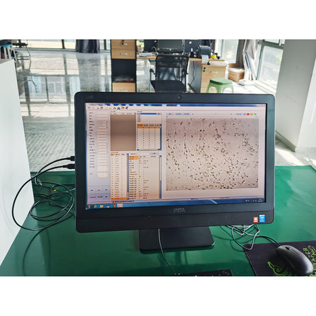 Fully Automatic Semen Analyzer Sperm Quality Analyzer