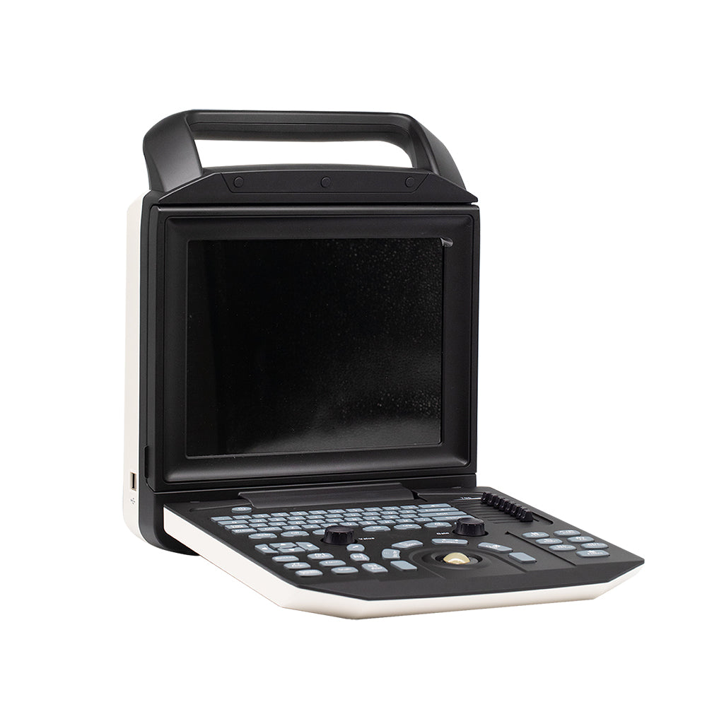 Color Doppler Ultrasound System Full Digital Portable Ultrasonic Diagnostic System