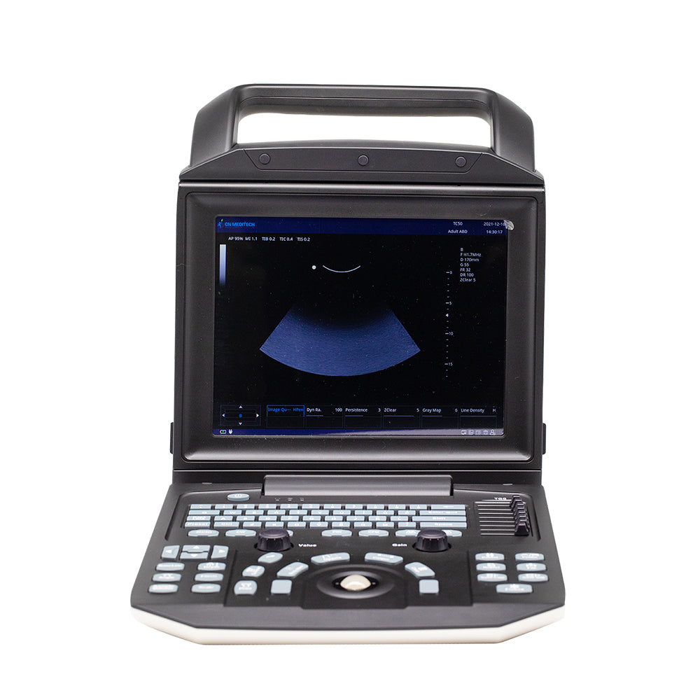 Color Doppler Ultrasound System Full Digital Portable Ultrasonic Diagnostic System