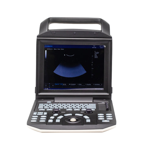 Color Doppler Ultrasound System Full Digital Portable Ultrasonic Diagnostic System