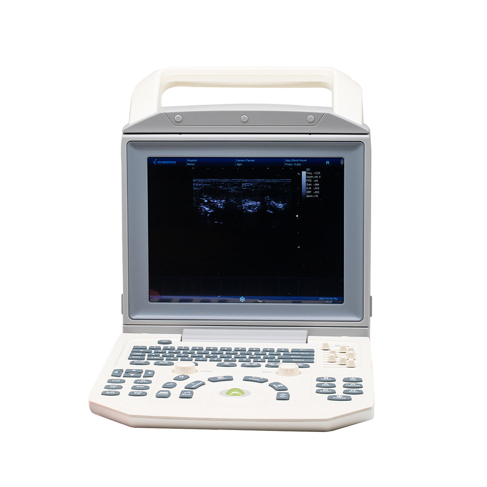 Black And White Ultrasound Machine Human Veterinary Outstanding Rotable Screen B/W Ultrasound Machine