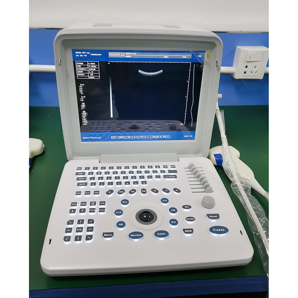 Laptop B/W Ultrasound Scanner Portable Full Digital Clinic Ultrasound Scanner