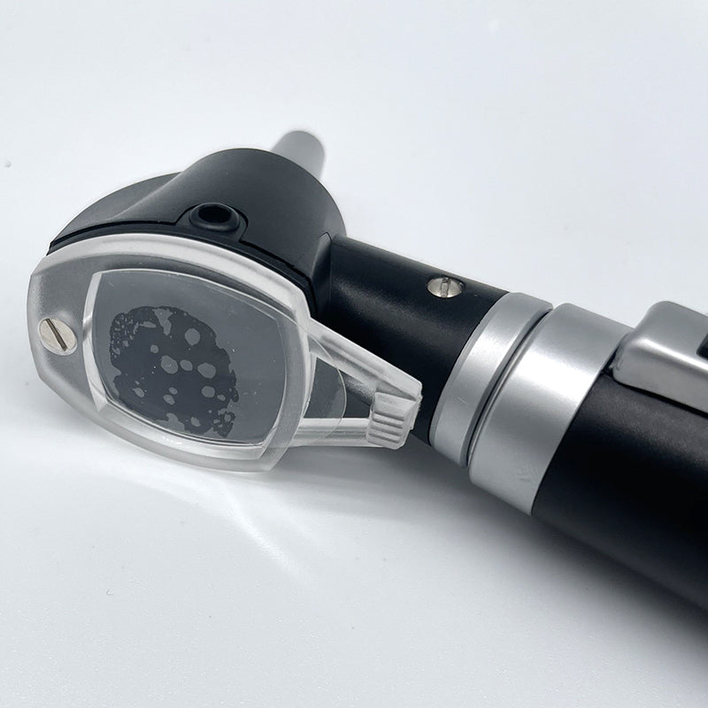 Portable Direct Illumination Otoscope for Ear Diagnostic