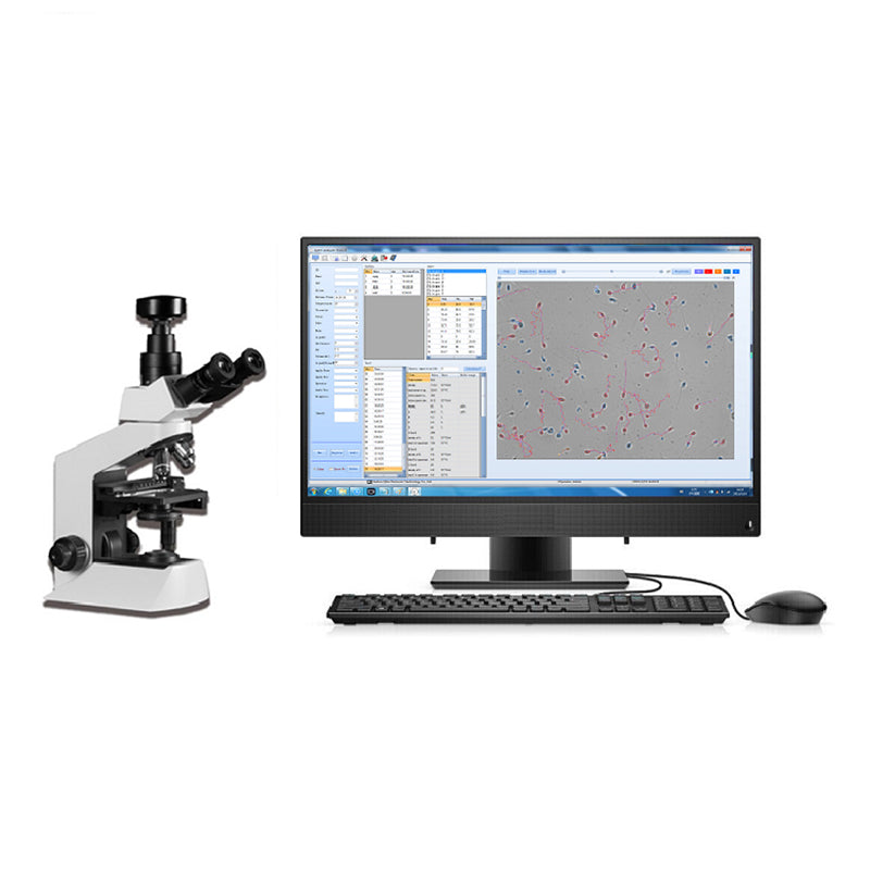 Semen Analysis Machine Microscope Sperm Quality Analyzer