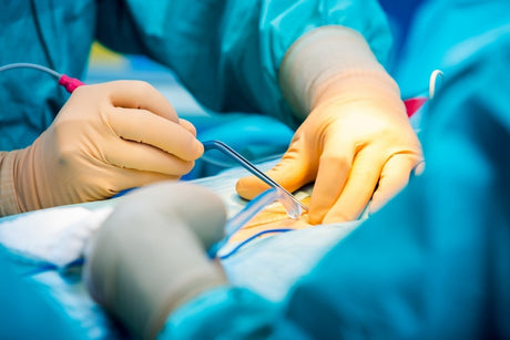The Difference Between High Frequency Electrosurgery and Radiofrequency Electrosurgery