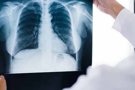 X-Ray Film Explained: Types, Uses, Sizes, and Key Features
