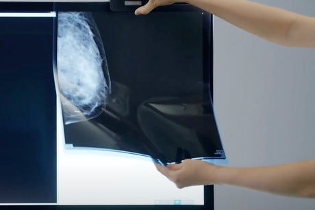 How to Clean and Maintain an X-Ray Film Viewer: Professional Protocol & Procurement Maintenance Guide