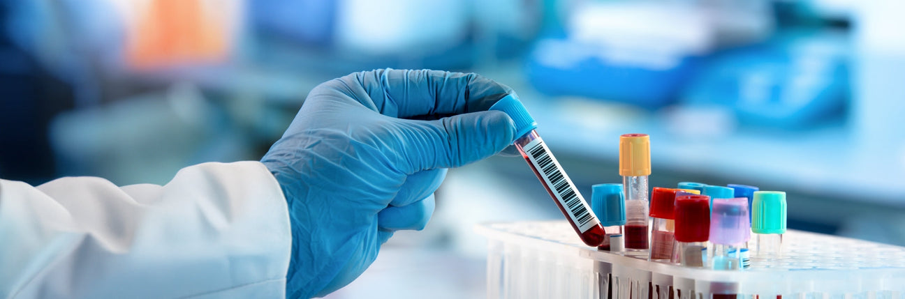 Immune analyzer