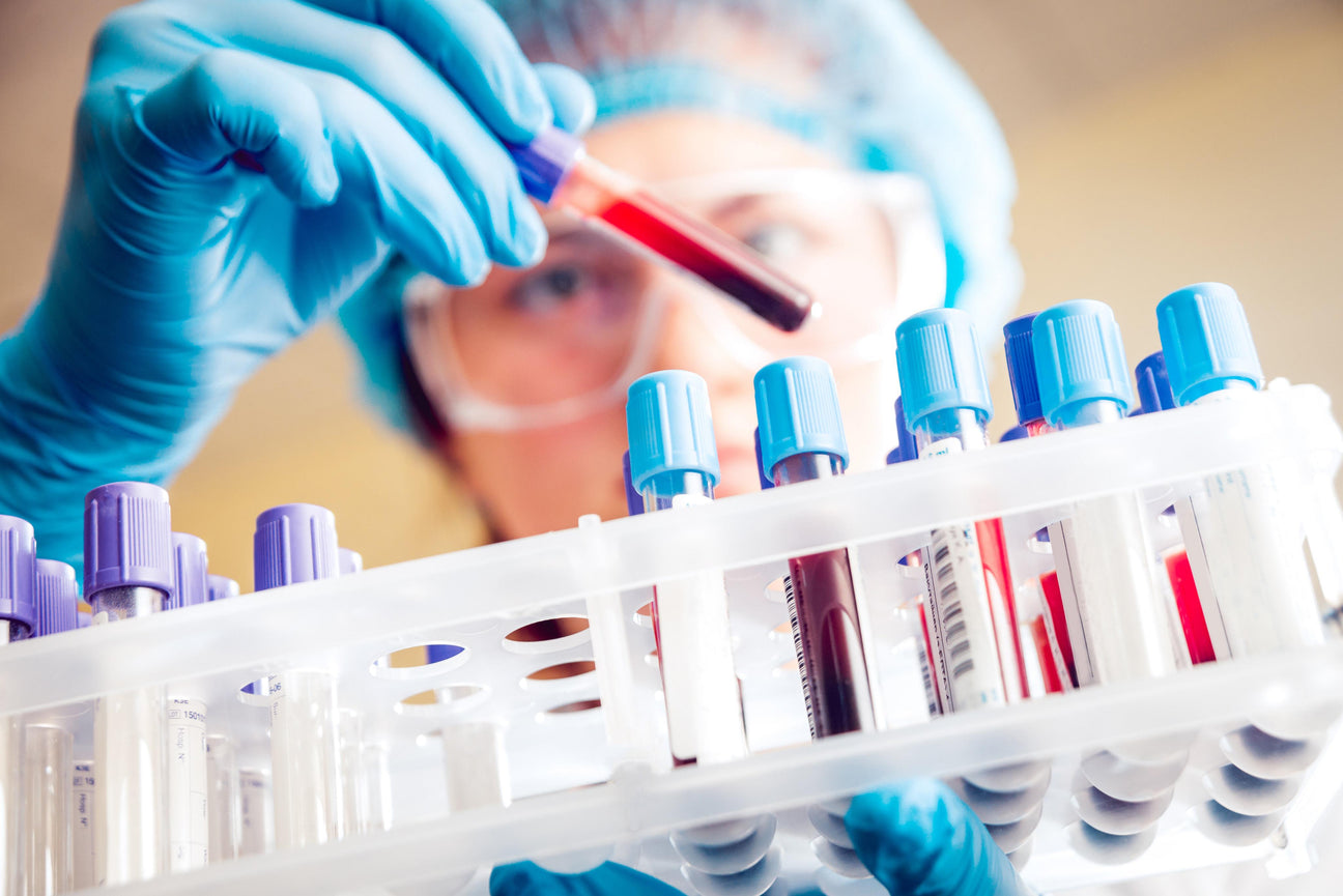 Blood gas analyzer