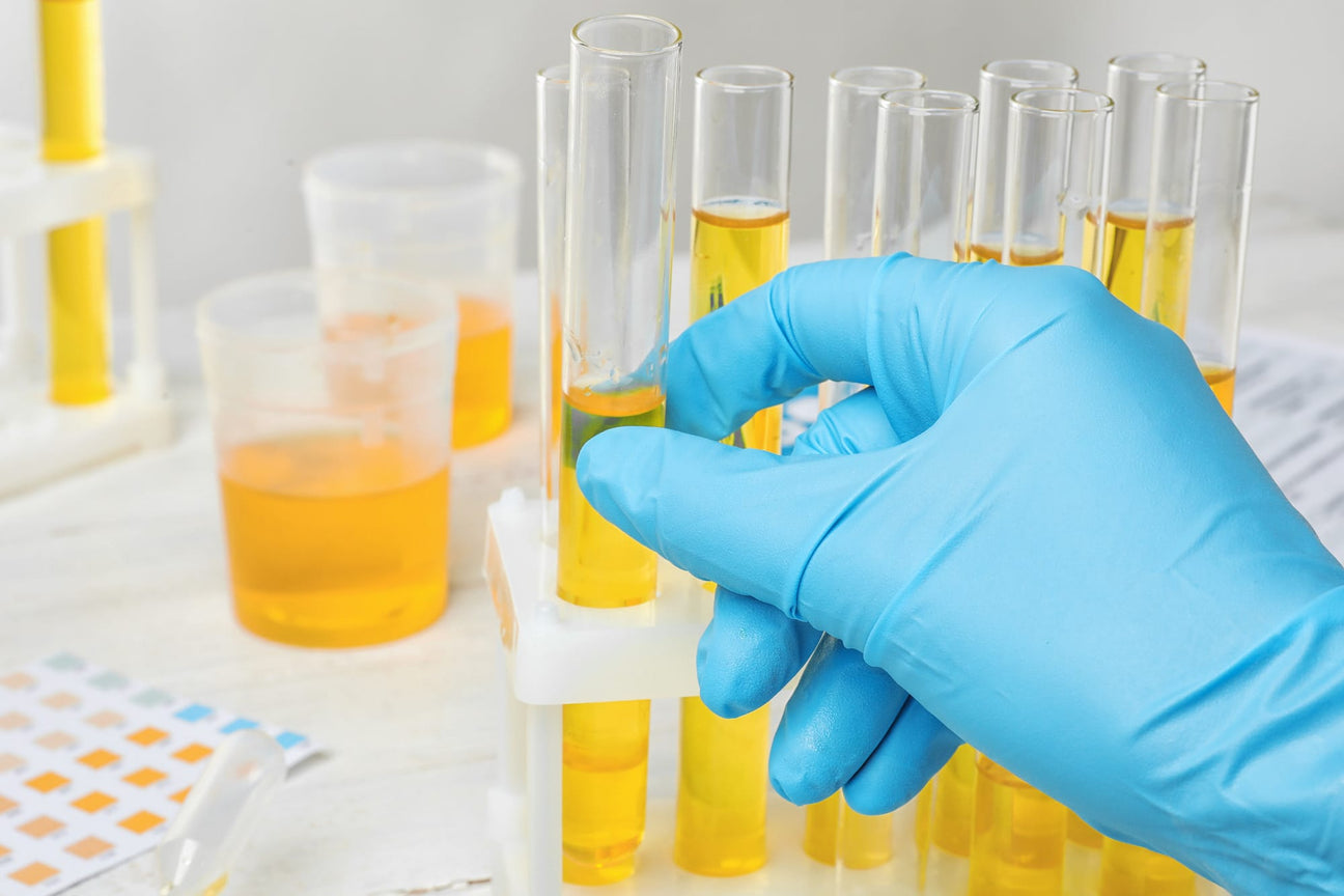 Urine analyzer