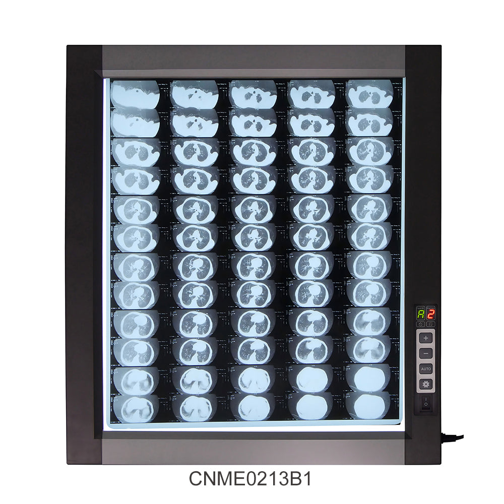 LED X-Ray Imaging Film Viewer Sidelight Mode X-Ray Film Viewer