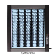 LED X-Ray Imaging Film Viewer Sidelight Mode X-Ray Film Viewer