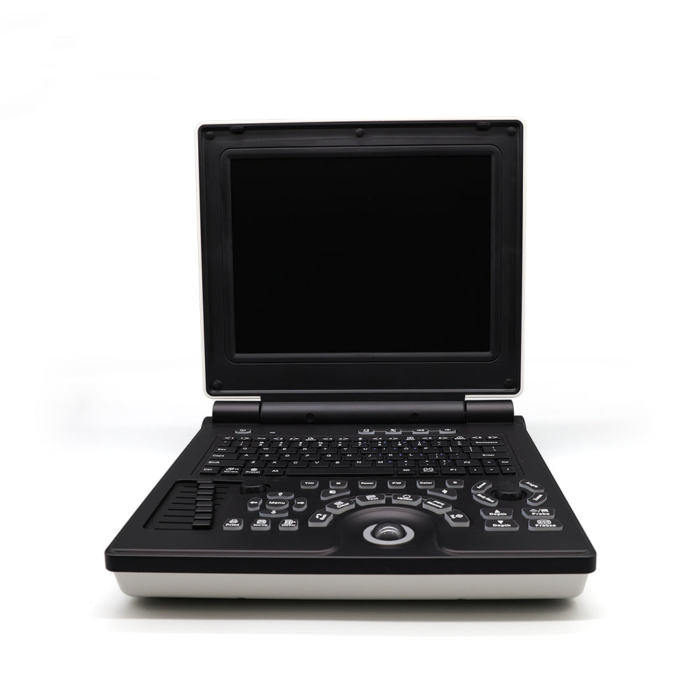 Portable Color Doppler Ultrasonic Machine Full Digital Clinic Ultrasound Machine