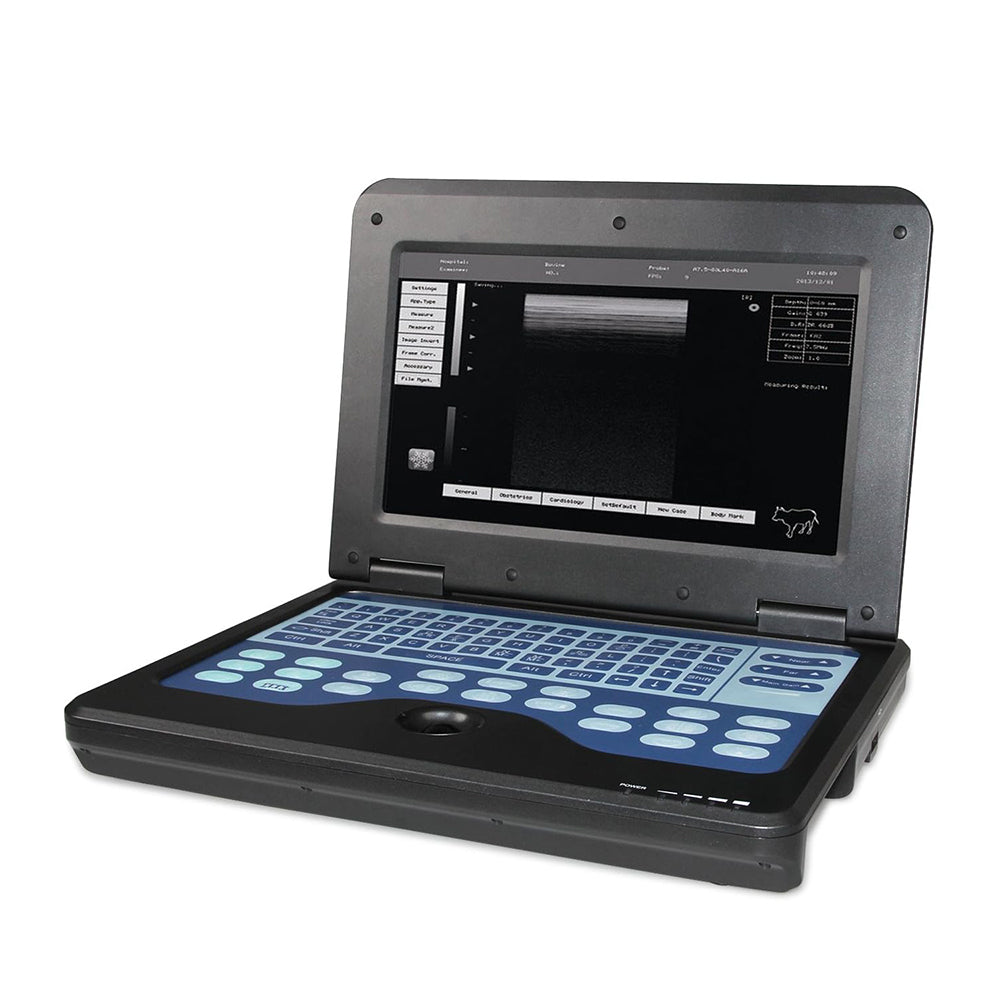 FDA Desktop B-Ultrasound Diagnostic System