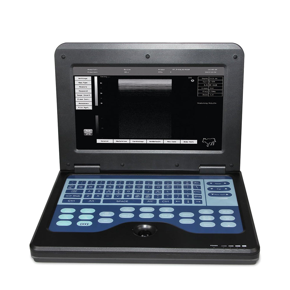 FDA Desktop B-Ultrasound Diagnostic System