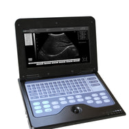 FDA Desktop B-Ultrasound Diagnostic System