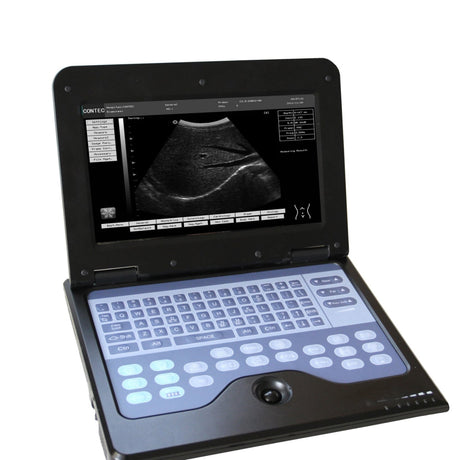 FDA Desktop B-Ultrasound Diagnostic System