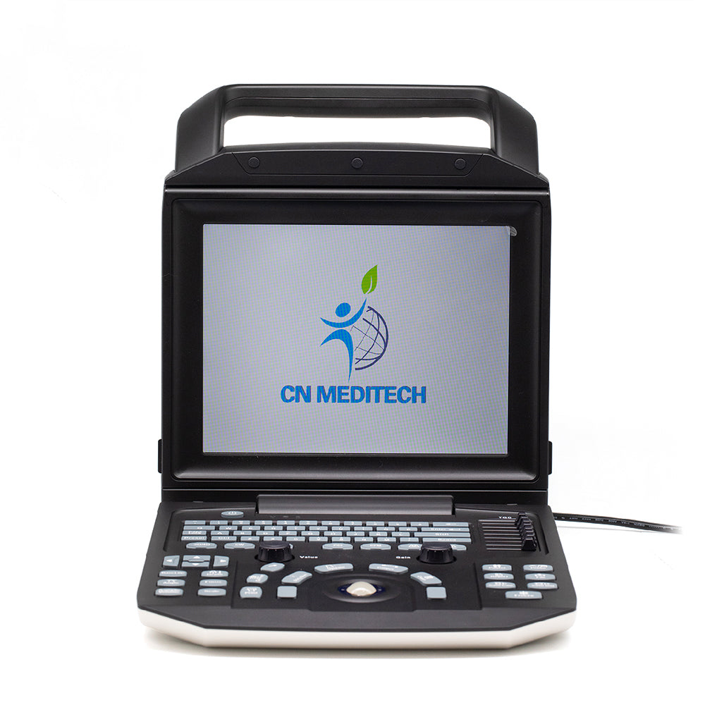 Color Doppler Ultrasound System Full Digital Portable Ultrasonic Diagnostic System
