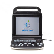 Color Doppler Ultrasound System Full Digital Portable Ultrasonic Diagnostic System