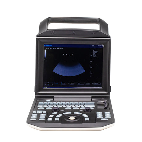 Ultrasonic Diagnostic System Full Digital Portable Color Doppler Ultrasound System
