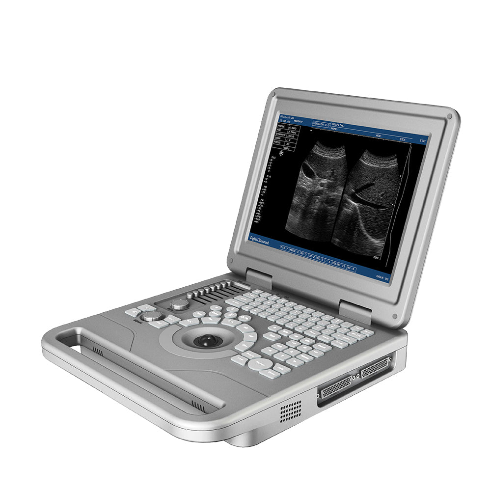Ultrasound Scanning Machine Notebook B/W Ultrasound Machine