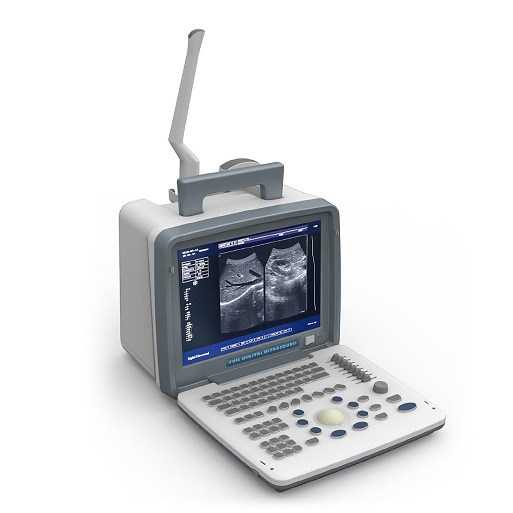 Laptop B/W Ultrasound Scanner Portable Full Digital Clinic Ultrasound Scanner