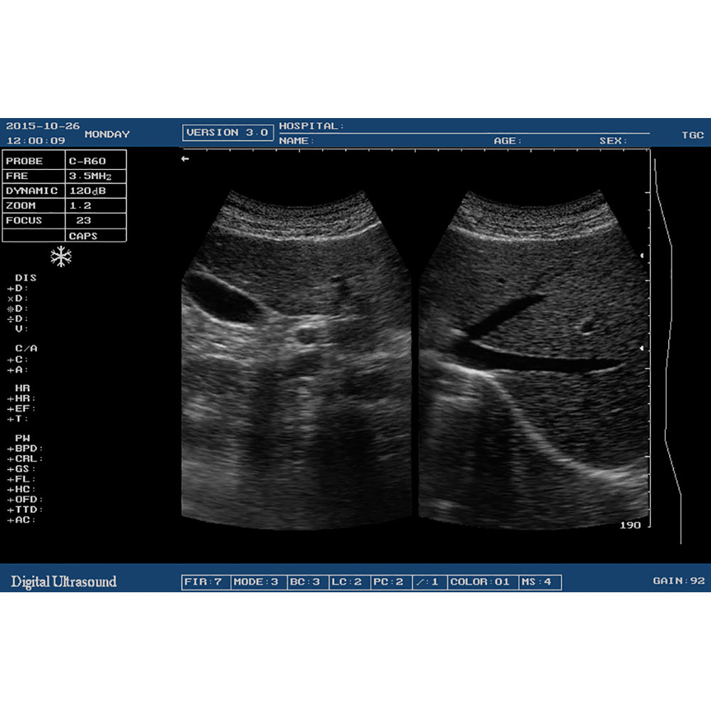 Ultrasound Scanning Machine Notebook B/W Ultrasound Machine