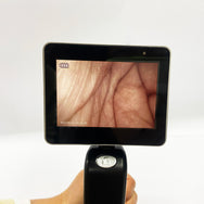 Surgical Laryngoscope 3'' TFT OLED Portable Video Laryngoscope with Reusable Blades