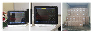 In Stock Beside Patient Monitor General Ward Use Patient Monitor