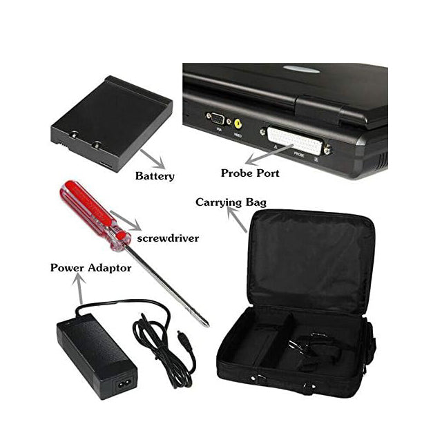 FDA Desktop B-Ultrasound Diagnostic System
