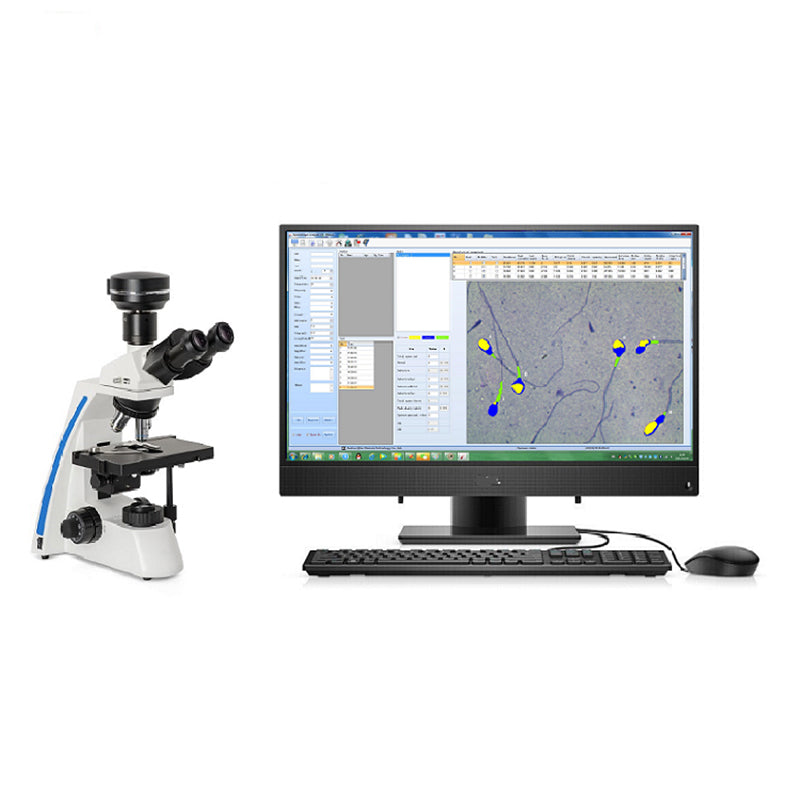 Semen Analyser Portable Laptop Semen Analysis Sperm Analyzer