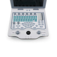 All Departments Use Economical Portable Color Doppler Ultrasound Machine